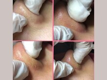 セリジェ 青山(Cerisier)/こんなに汚れが出ます！！！