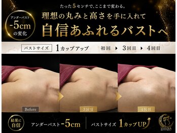 ヴェルナ(VELUNA)の写真/骨格・姿勢から整え、女性らしいデコルテと美胸ラインへ導く結果重視ケア♪