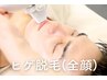 【メンズ脱毛】ヒゲ脱毛(全顔+首)コース! 2回目以降 30分