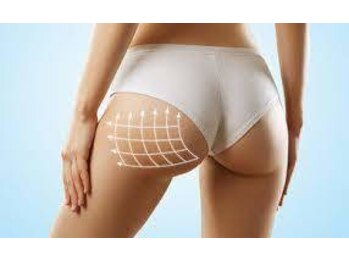 ビューティーサロン ラ ルーチェ(beauty salon La Luce)/【施術に追加】引締ラジショット