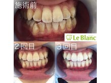 ルブラン 奈良店(Le Blanc)/お試しクーポン