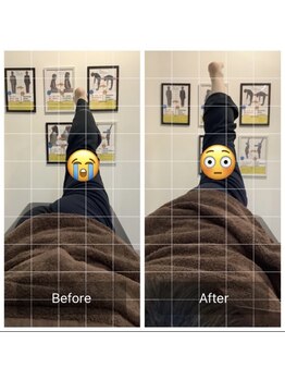 ナオル整体 三宮院(NAORU整体)/20代女性整体事例【腰痛】