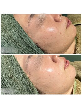 ミロク(MIROKU.)/陶肌トリートメント