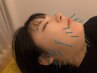 【フェイスライン スッキリ！】フェイスライン重点 美容鍼灸　¥6,270