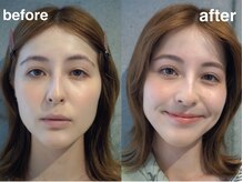 エンバー 吉祥寺(embr.)/【アイブロウ】眉毛サロン