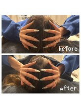 ルビー 池袋店(Ruby)/頭蓋骨矯正1回ビフォーアフター