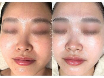 ウォナ(WONA)/【お客様症例】