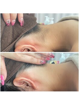 ミース 北九州店/うなじ●ビフォーアフター