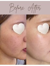 メルシー(merci)/ダクトピール