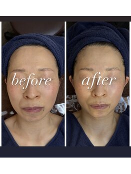 ソルテケア(SORTE*care)/美顔「πフェイシャル」