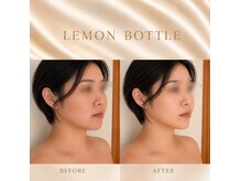 ブリリアントスマイルの雰囲気（レモンボトルで二重顎・フェイスラインをスッキリ小顔へ　与那原）