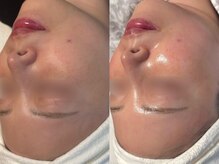 TEN Aesthetic【艶肌・肌質改善・五臓漢方よもぎ蒸し】【7/2　NEW　OPEN（予定）】/施術1回でも艶肌♪