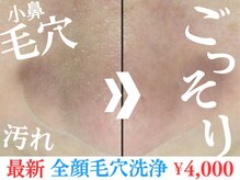 チル(chill)