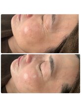 エスポワール(Espoir)/