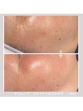 モフ(mof.)/マリムーブフェイシャルワックス