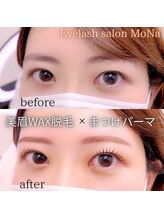 モナ(MoNa)/美眉WAX脱毛×まつげパーマ