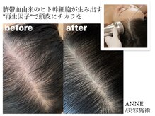 アンネ ビューティー クリニーク(ANNE BEAUTY CLINIQUE)の雰囲気（【大通駅1番出口徒歩30秒】am10:00～最終受付pm19:30他要相談）