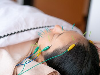 プラチナサロン 六本木/＃美容鍼　＃毛穴