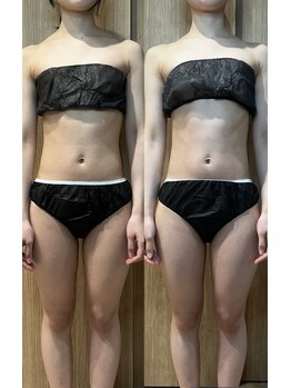 オトサロン(Otosalon)/リラックス効果抜群！マッサージ