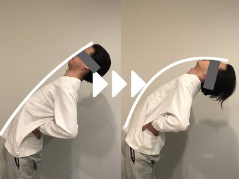 ミライズ整体院 三宮本院/事例【30代男性・腰痛】