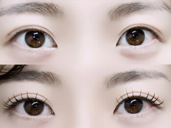 ロピ 江坂(LOPI)/&Healthy(アンドヘルシー)120本