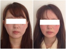 美容整体 ウェリナ 蟹江院/小顔矯正/骨盤矯正/美脚サロン