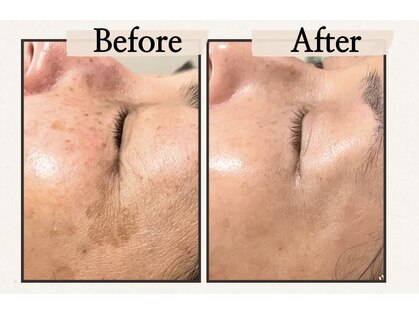 ハーティー(Hearty)の写真