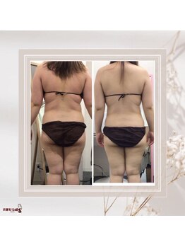 効くラボ 梅田店/2ヶ月で変われます