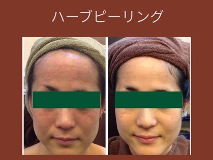 エステサロン プラスエー(+A)の写真