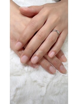 クリアジェル補強