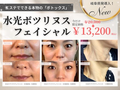 カリスボーテ 関本店の写真