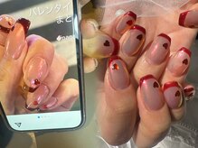 自爪持ち込み