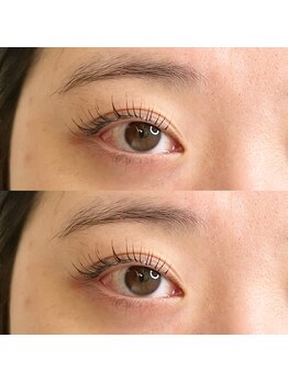 ステラ(STELLA)/全体的に丸みをつけたデザイン