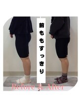 スタイルラボ高松/産後骨盤矯正の効果♪