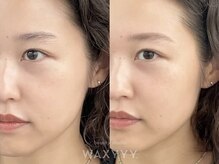 ハリウッドブロウリフト ワクシー 青山店(HOLLYWOOD BROW LIFT WAXYYY.)/プロに任せる自眉ケア