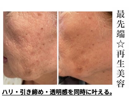 ピュウリリアーナ(PIU LILIANA)の写真