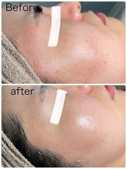 ルミネル 名古屋新栄(Luminelle)/うるもち