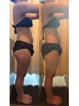 杏/歪んだ身体とさようなら