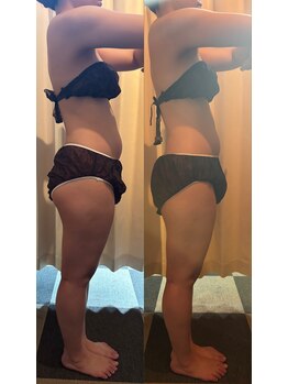 杏/歪んだ身体とさようなら