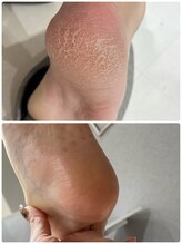 シグネイルスタジオ(CYiG nail studio)/足裏角質ケア