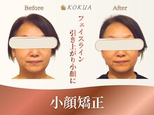 痩身専門店エステティックサロン コクア(KOKUA)の雰囲気（【小顔矯正】美骨格フェイスで顔の左右差スッキリ&骨格から小顔!）