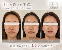 エクラヴィ(Eclatvie)