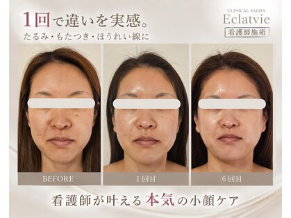 エクラヴィ(Eclatvie)の写真