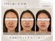 エクラヴィ(Eclatvie)の写真