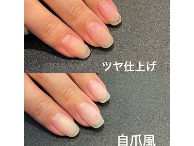 ジェルを使用した育成は2種類☆ご相談ください