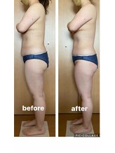 ビンナ 五反田店(Binna)/腸マッサージでお腹引き締め