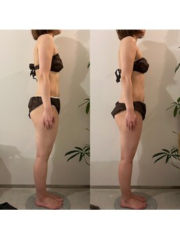 ラナ 京都西院店(Lana)/よもぎ＆全身リンパマッサージ