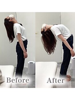 アマテル(AMATERU)/Before/After1