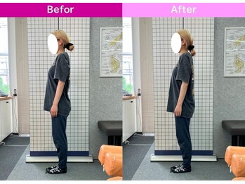八女整体院/~姿勢改善~首・肩の痛み