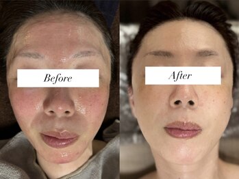 ジョーヌ(JAUNE)/劇的なトーンアップ